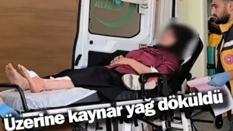 Üzerine kaynar yağ döküldü 