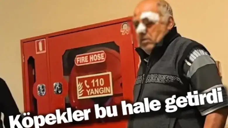 Köpekler bu hale getirdi