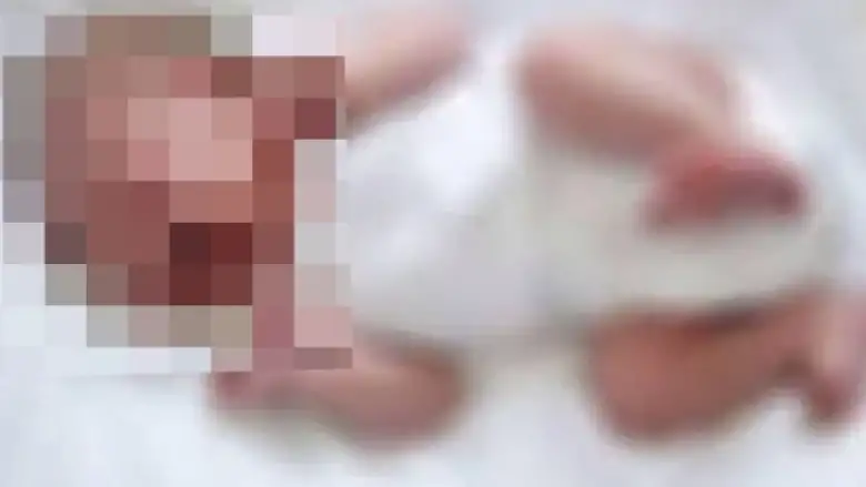 3 yaşındaki çocuğun üzerine çaydanlık devrildi!