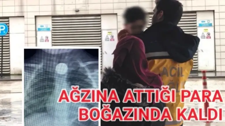 İnegöl'de ağzına attığı para boğazında kaldı