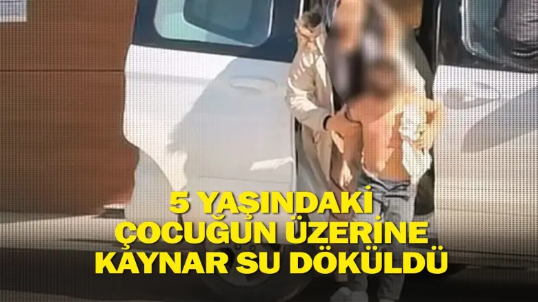 5 yaşındaki çocuğun üzerine kaynar su döküldü