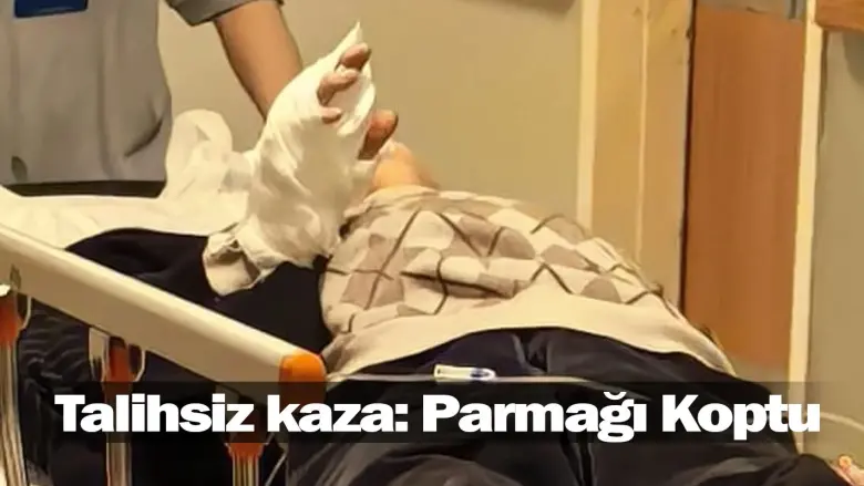 İnegöl'de talihsiz kaza: Parmağı Koptu