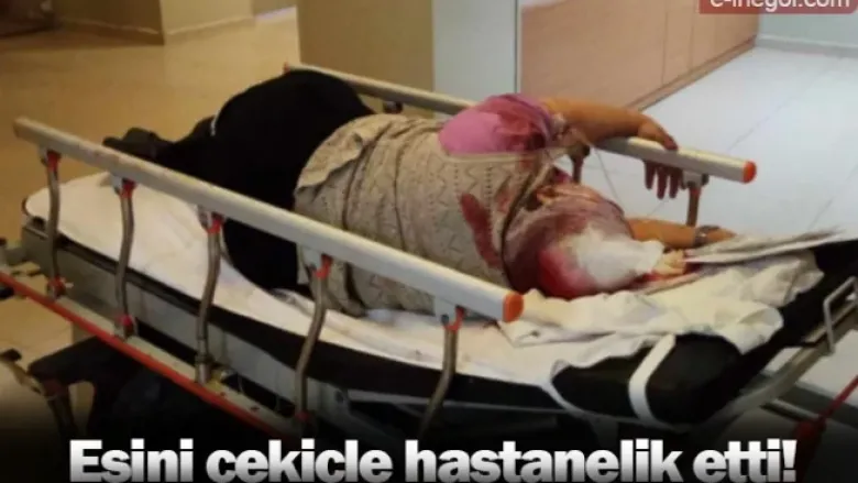 Eşini çekiçle hastanelik etti!