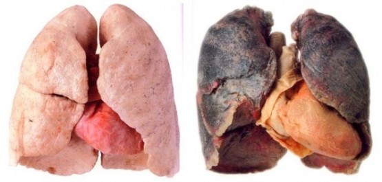 Sigara İçenler Bu Haber Sizin İçin! İşte Akciğerleri Temizlemenin Kolay Yolu...