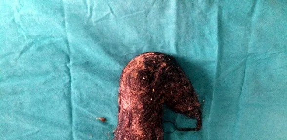 Doktorlar Bile Hayrete Düştü