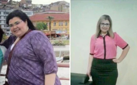 78 Kilo Verdi Hayatı Değişti
