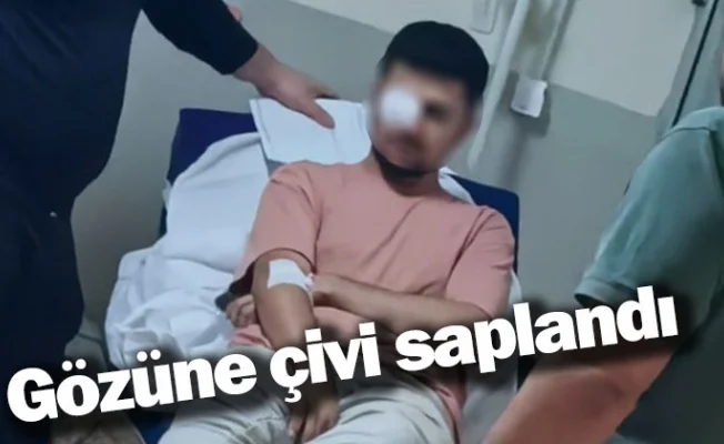 Gözüne çivi saplandı