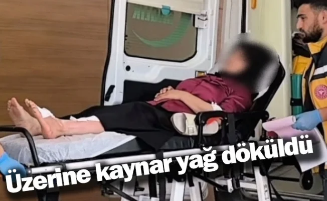 Üzerine kaynar yağ döküldü 