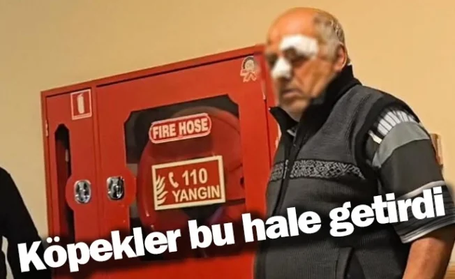 Köpekler bu hale getirdi