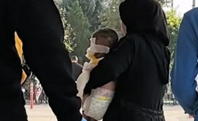 Hayatının şokunu yaşadı! 1,5 yaşındaki çocuk ...