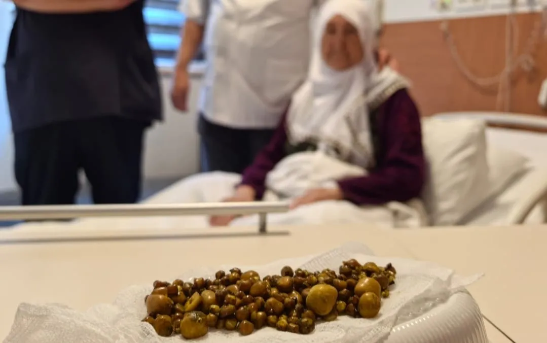 Safra kesesinden çıkanlar şoke etti!