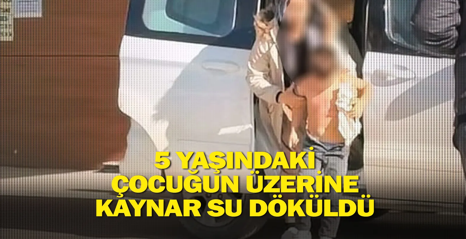 5 yaşındaki çocuğun üzerine kaynar su döküldü