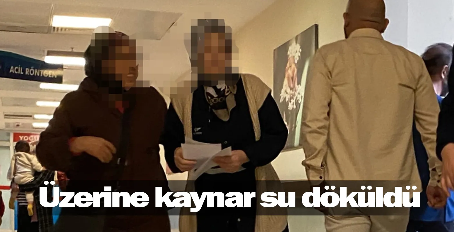 Üzerine kaynar su döküldü