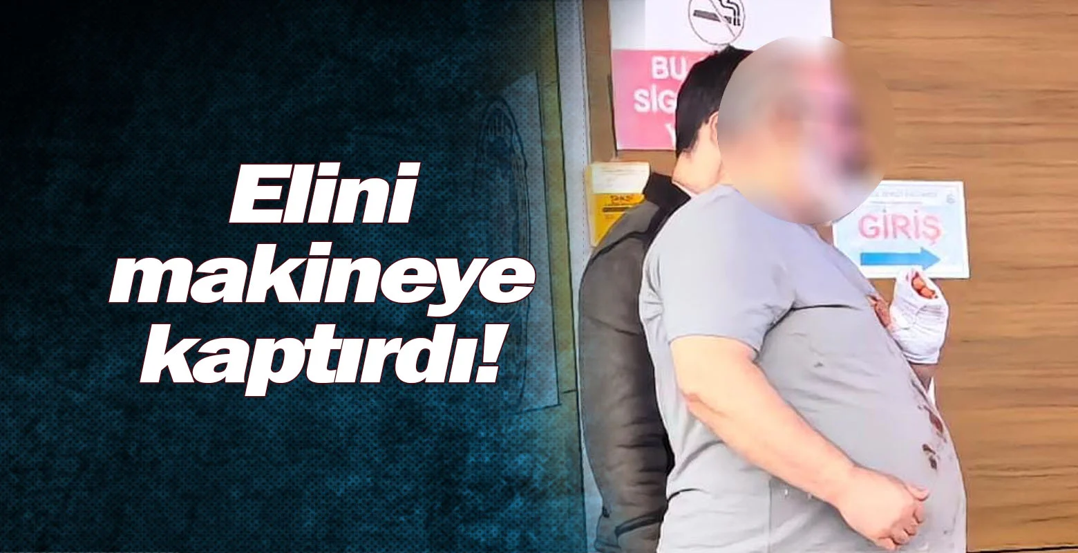 Elini makineye kaptırdı!