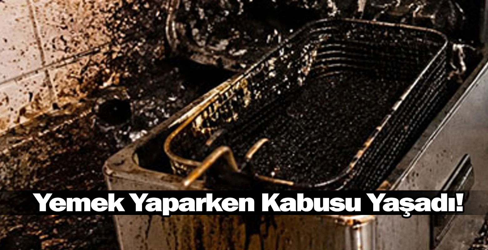 Yemek Yaparken Kabusu Yaşadı!